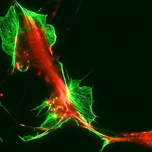 fluorescence microscopes