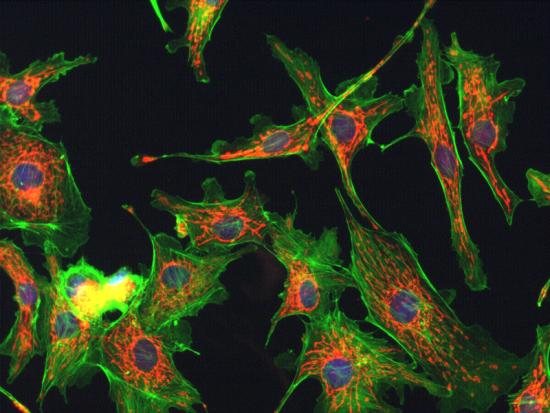 fluorescence microscopy image of cells